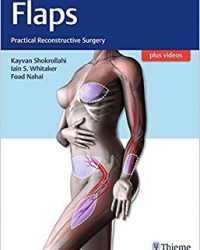 Flaps: Practical Reconstructive Surgery, 1e (Original Publisher PDF)