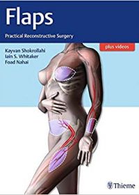 Flaps: Practical Reconstructive Surgery, 1e (Original Publisher PDF)