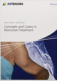 Concepts and Cases in Nonunion Treatment, 1e (Original Publisher PDF)