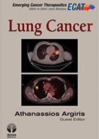 Lung Cancer, 1e (Original Publisher PDF)