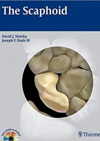 The Scaphoid, 1e (Original Publisher PDF)