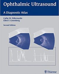 Ophthalmic Ultrasound: A Diagnostic Atlas, 2e (Original Publisher PDF)