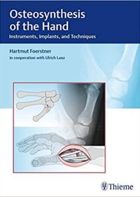 Osteosynthesis of the Hand: Instruments, Implants, and Techniques, 1e (Original Publisher PDF)