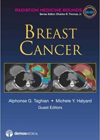 Breast Cancer, 1e (Original Publisher PDF)