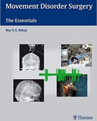 Movement Disorder Surgery: The Essentials, 1e (Original Publisher PDF)