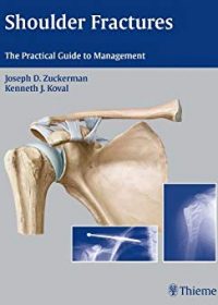 Shoulder Fractures: The Practical Guide to Management, 1e (Original Publisher PDF)