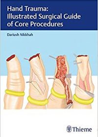 Hand Trauma: Illustrated Surgical Guide of Core Procedures, 1e (Original Publisher PDF)