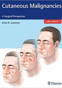 Cutaneous Malignancies: A Surgical Perspective, 1e (Original Publisher PDF)