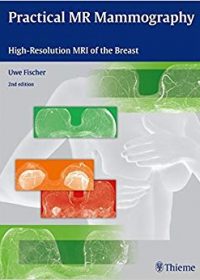 Practical MR Mammography: High-Resolution MRI of the Breast, 2e (Original Publisher PDF)