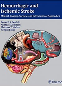 Hemorrhagic and Ischemic Stroke: Medical, Imaging, Surgical and Interventional  Approaches, 1e (Original Publisher PDF)