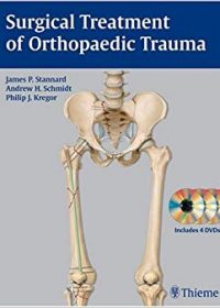 Surgical Treatment of Orthopaedic Trauma, 1e (Original Publisher PDF)