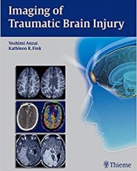 Imaging of Traumatic Brain Injury, 1e (Original Publisher PDF)