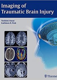 Imaging of Traumatic Brain Injury, 1e (Original Publisher PDF)