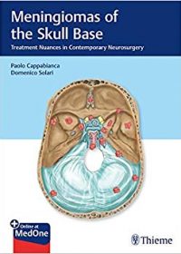 Meningiomas of the Skull Base: Treatment Nuances in Contemporary Neurosurgery, 1e (Original Publisher PDF)