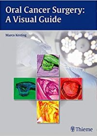 Oral Cancer Surgery: A Visual Guide, 1e (Original Publisher PDF)