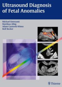 Ultrasound Diagnosis of Fetal Anomalies, 1e (Original Publisher PDF)