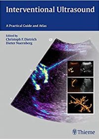 Interventional Ultrasound: A Practical Guide and Atlas, 1e (Original Publisher PDF)