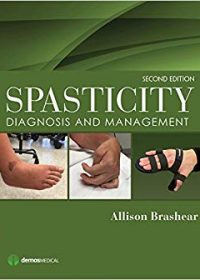 Spasticity: Diagnosis and Management, 2e (Original Publisher PDF)