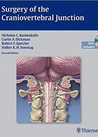Surgery of the Craniovertebral Junction, 2e (Original Publisher PDF)