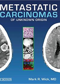 Metastatic Carcinomas of Unknown Origin, 1e (Original Publisher PDF)