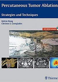 Percutaneous Tumor Ablation: Strategies and Techniques, 1e (Original Publisher PDF)