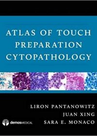 Atlas of Touch Preparation Cytopathology, 1e (Original Publisher PDF)