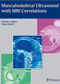 Musculoskeletal Ultrasound with MRI Correlations, 1e (Original Publisher PDF)