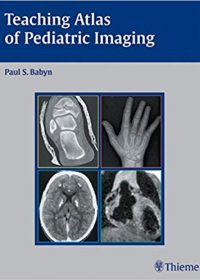 Teaching Atlas of Pediatric Imaging, 1e (Original Publisher PDF)