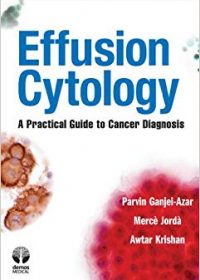 Effusion Cytology: A Practical Guide to Cancer Diagnosis, 1e (Original Publisher PDF)