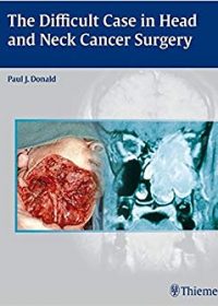 The Difficult Case in Head and Neck Cancer Surgery, 1e (Original Publisher PDF)