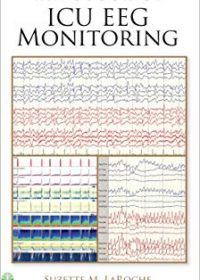 Handbook of ICU EEG Monitoring, 1e (Original Publisher PDF)