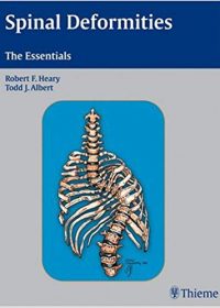 Spinal Deformities: The Essentials, 1e (Original Publisher PDF)