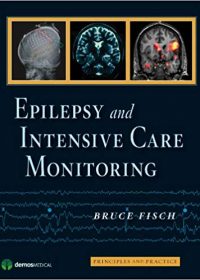 Epilepsy and Intensive Care Monitoring: Principles and Practice, 1e (Original Publisher PDF)