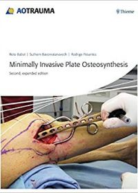 Minimally Invasive Plate Ostheosynthesis, 2e (Original Publisher PDF)