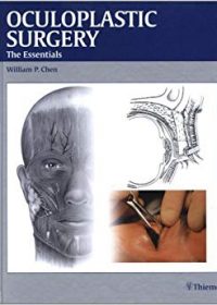 Oculoplastic Surgery: The Essentials, 1e (Original Publisher PDF)