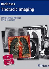 Radcases Thoracic Imaging, 1e (Original Publisher PDF)