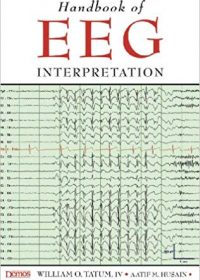 Handbook of Eeg Interpretation, 1e (Original Publisher PDF)