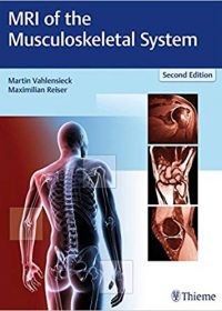 MRI of the Musculoskeletal System, 2e (Original Publisher PDF)