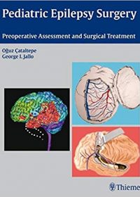 Pediatric Epilepsy Surgery: Preoperative Assessment and Surgical Treatment, 1e (Original Publisher PDF)