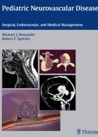 Pediatric Neurovascular Disease: Surgical, Endovascular and Medical Management, 1e (Original Publisher PDF)