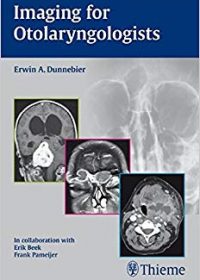 Imaging for Otolaryngologists, 1e (Original Publisher PDF)