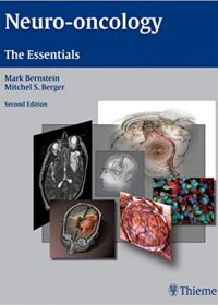 Neuro-oncology: The Essentials, 2e (Original Publisher PDF)