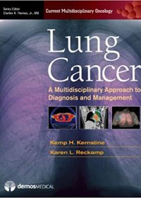 Lung Cancer: A Multidisciplinary Approach to Diagnosis and Management, 1e (Original Publisher PDF)