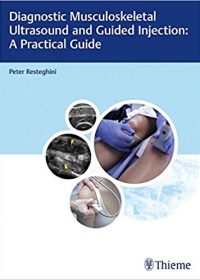 Diagnostic Musculoskeletal Ultrasound and Guided Injection: A Practical Guide, 1e (Original Publisher PDF)