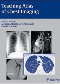 Teaching Atlas of Chest Imaging, 1e (Original Publisher PDF)