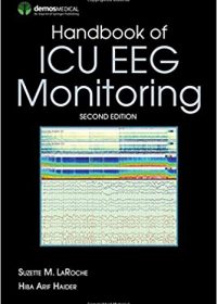 Handbook of ICU EEG Monitoring, 2e (Original Publisher PDF)