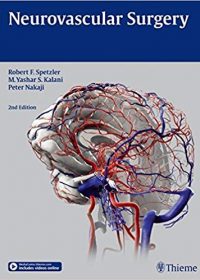 Neurovascular Surgery, 2e (Original Publisher PDF)