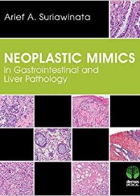 Neoplastic Mimics in Gastrointestinal and Liver Pathology, 1e (Original Publisher PDF)