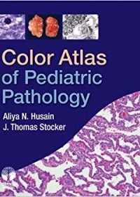 Color Atlas of Pediatric Pathology, 1e (Original Publisher PDF)