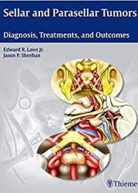 Sellar and Parasellar Tumors: Diagnosis, Treatments, and Outcomes, 1e (Original Publisher PDF)